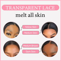 lace closure wig